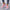 Birgit | Comfortable Orthopedic Shoes for Breathable, Pain-Free Mobility
